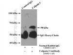 Calpain 3 Antibody in Immunoprecipitation (IP)