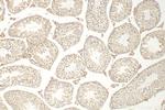 HOXD3 Antibody in Immunohistochemistry (Paraffin) (IHC (P))