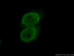TFII I Antibody in Immunocytochemistry (ICC/IF)