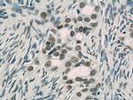 TFII I Antibody in Immunohistochemistry (Paraffin) (IHC (P))