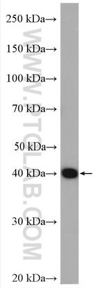 PSAT1 Antibody in Western Blot (WB)