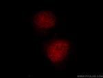 TCEB3 Antibody in Immunocytochemistry (ICC/IF)