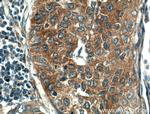 KEAP1 Antibody in Immunohistochemistry (Paraffin) (IHC (P))