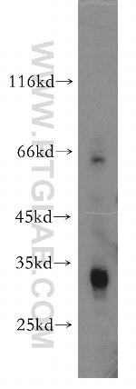 ZMAT3 Antibody in Western Blot (WB)