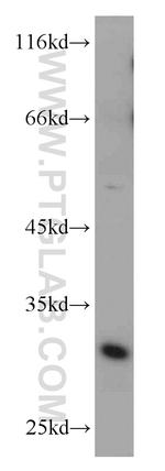 ZMAT3 Antibody in Western Blot (WB)
