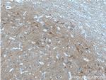 NCS1 Antibody in Immunohistochemistry (Paraffin) (IHC (P))