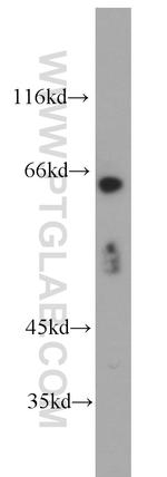 PDZK1 Antibody in Western Blot (WB)