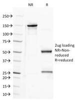 CD100 (Semaphorin-4D) Monoclonal Antibody (A8)