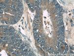 RhoGDI Antibody in Immunohistochemistry (Paraffin) (IHC (P))