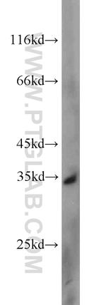 UCK2 Antibody in Western Blot (WB)