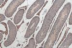 Kallikrein 5 Antibody in Immunohistochemistry (Paraffin) (IHC (P))