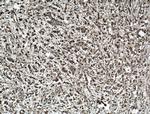 LASP1 Antibody in Immunohistochemistry (Paraffin) (IHC (P))