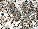 LASP1 Antibody in Immunohistochemistry (Paraffin) (IHC (P))