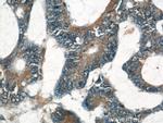 LASP1 Antibody in Immunohistochemistry (Paraffin) (IHC (P))