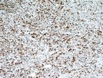 LASP1 Antibody in Immunohistochemistry (Paraffin) (IHC (P))