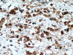 LASP1 Antibody in Immunohistochemistry (Paraffin) (IHC (P))