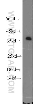 LASP1 Antibody in Western Blot (WB)