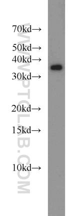 LASP1 Antibody in Western Blot (WB)