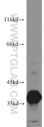 LASP1 Antibody in Western Blot (WB)