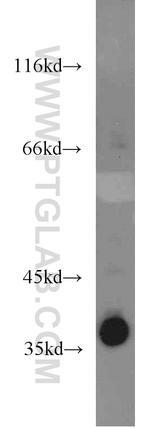 LASP1 Antibody in Western Blot (WB)