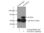 PACSIN2 Antibody in Immunoprecipitation (IP)
