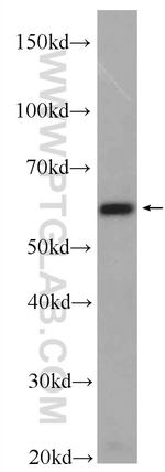 PACSIN2 Antibody in Western Blot (WB)