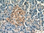PCMT1 Antibody in Immunohistochemistry (Paraffin) (IHC (P))