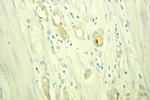 APOD Antibody in Immunohistochemistry (Paraffin) (IHC (P))