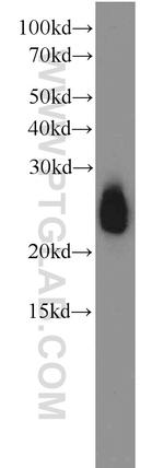 APOD Antibody in Western Blot (WB)