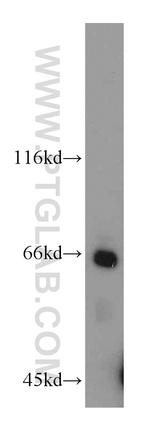 IFNAR2 Antibody in Western Blot (WB)