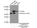 CRMP5 Antibody in Immunoprecipitation (IP)