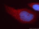 RRM1 Antibody in Immunocytochemistry (ICC/IF)