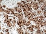 RRM1 Antibody in Immunohistochemistry (Paraffin) (IHC (P))