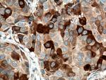 RRM1 Antibody in Immunohistochemistry (Paraffin) (IHC (P))