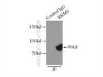 RRM1 Antibody in Immunoprecipitation (IP)