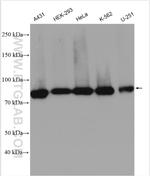 RRM1 Antibody in Western Blot (WB)