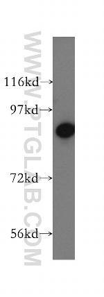 RRM1 Antibody in Western Blot (WB)