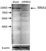 RRM1 Antibody in Western Blot (WB)