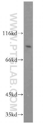 RRM1 Antibody in Western Blot (WB)