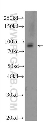 RRM1 Antibody in Western Blot (WB)