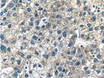 DAD1 Antibody in Immunohistochemistry (Paraffin) (IHC (P))