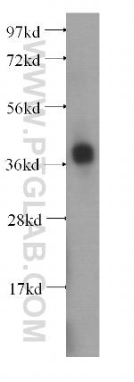 B4GALT7 Antibody in Western Blot (WB)