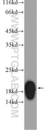 Dermatopontin Antibody in Western Blot (WB)