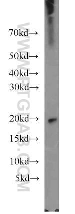 Dermatopontin Antibody in Western Blot (WB)