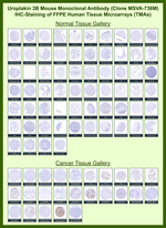 Uroplakin 3B (UPK3B) (Marker of Mesothelial & Umbrella Cells) Monoclonal Antibody (MSVA-736M)