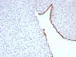 Uroplakin 3B (UPK3B) (Marker of Mesothelial and Umbrella Cells) Recombinant Rabbit Monoclonal Antibody (UPK3B/8768R)