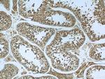Calpain 1 Antibody in Immunohistochemistry (Paraffin) (IHC (P))