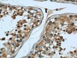 Calpain 1 Antibody in Immunohistochemistry (Paraffin) (IHC (P))