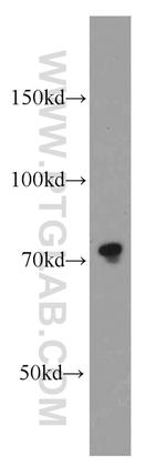 Calpain 1 Antibody in Western Blot (WB)