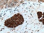 Calpain 1 Antibody in Immunohistochemistry (Paraffin) (IHC (P))